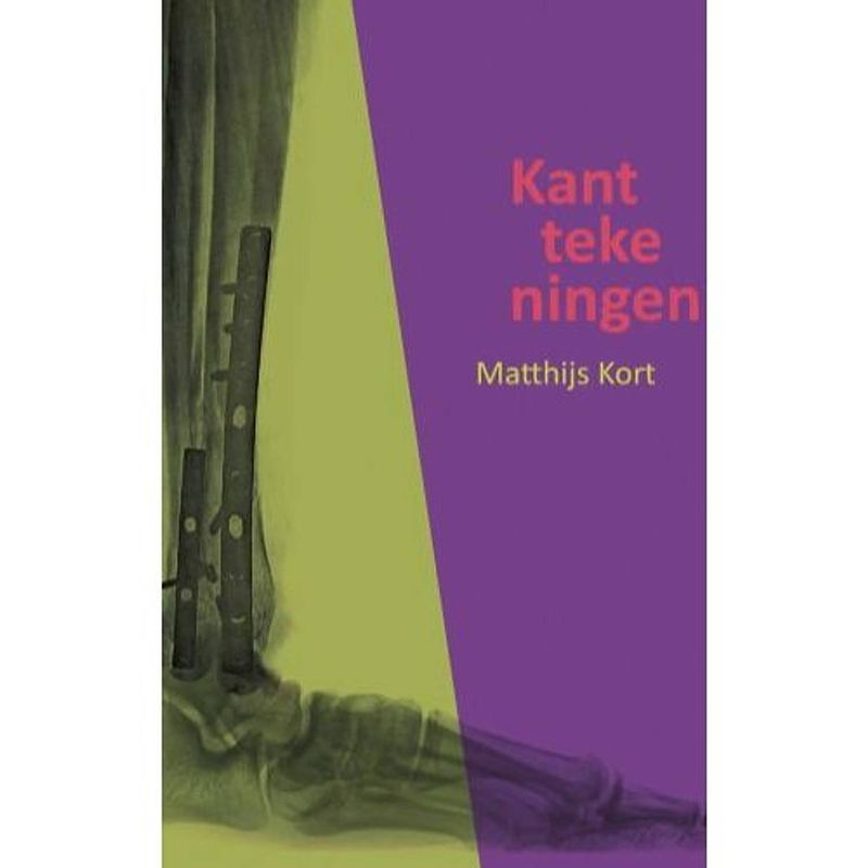 Foto van Kanttekeningen